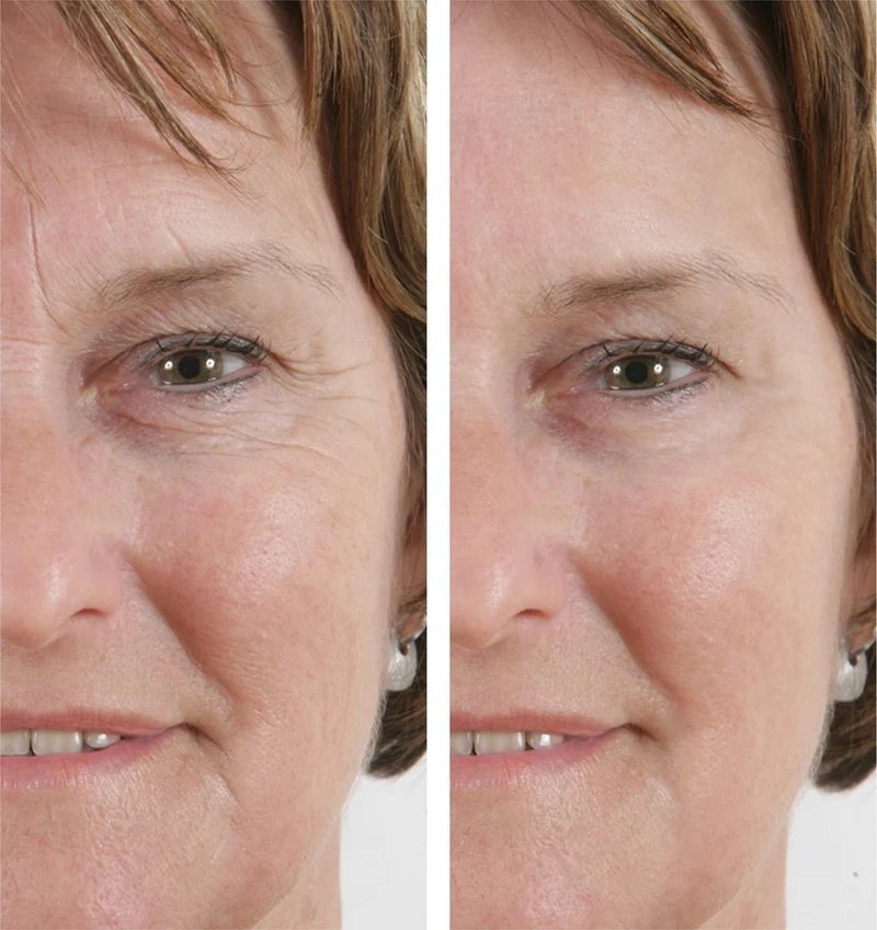 Power Tense - Wrinkle Power