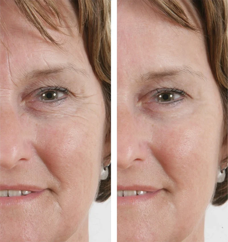Power Tense - Wrinkle Power